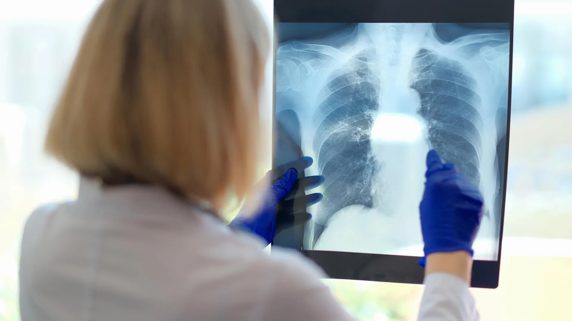 Um problema respiratório oculto pode estar por trás da exaustão debilitante da fadiga crônica.