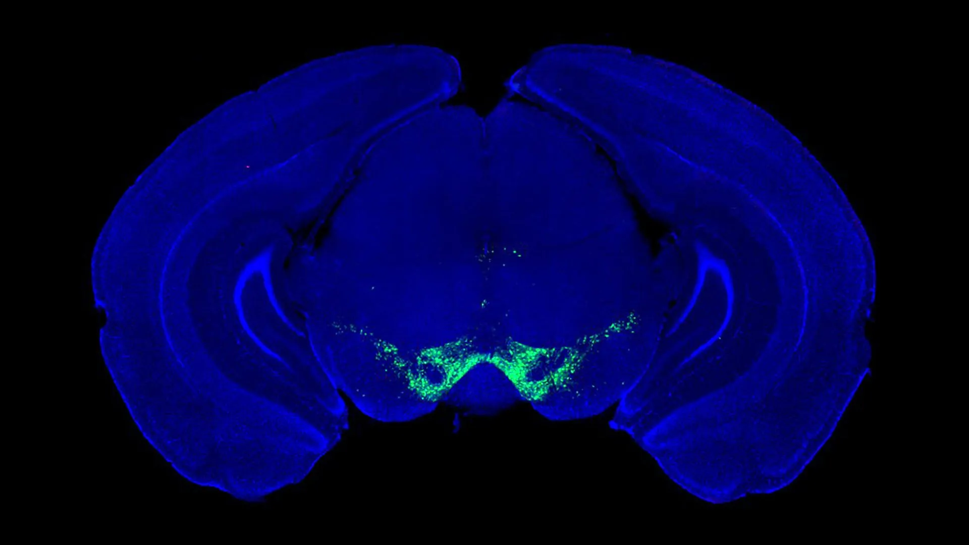 Avanço sobre Parkinson altera nossa compreensão da dopamina