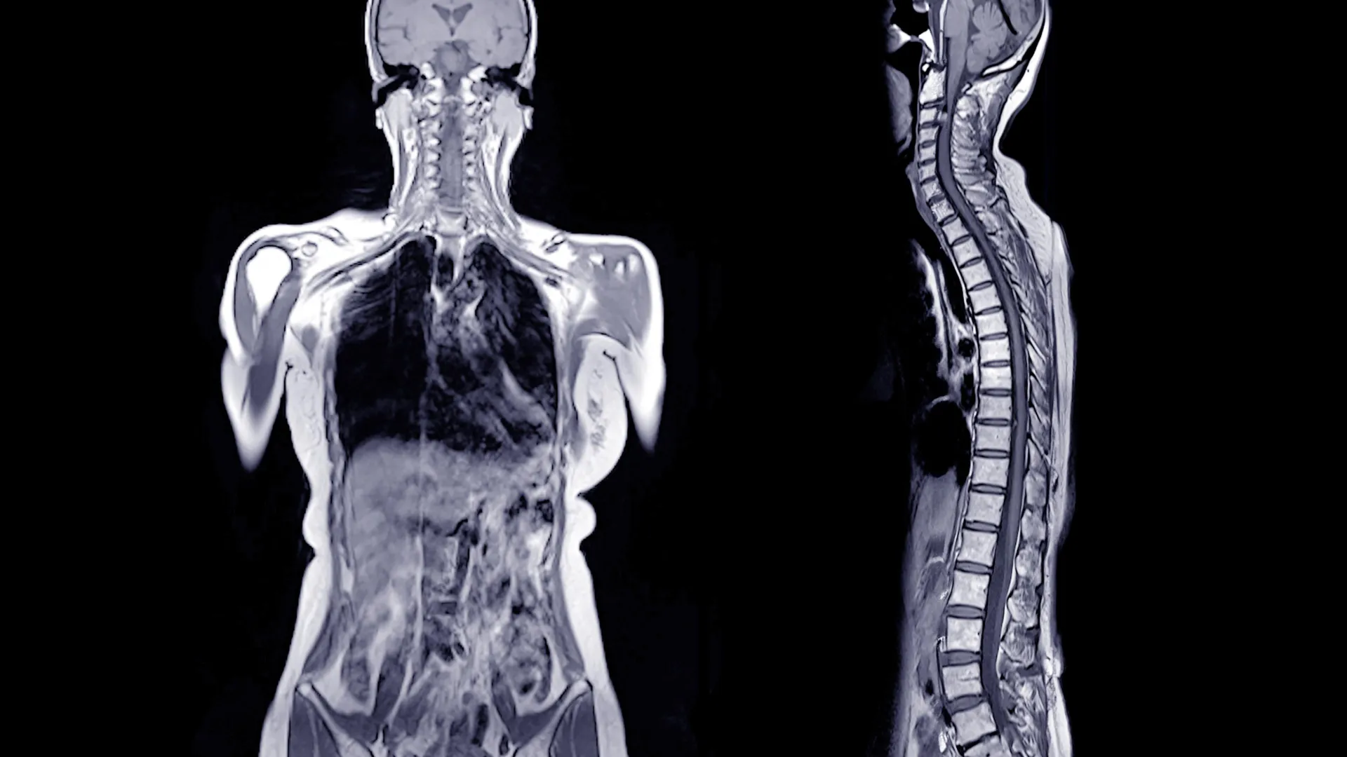 Ele consumiu um lanche e faleceu algumas horas depois. Médicos descobriram uma causa surpreendente.