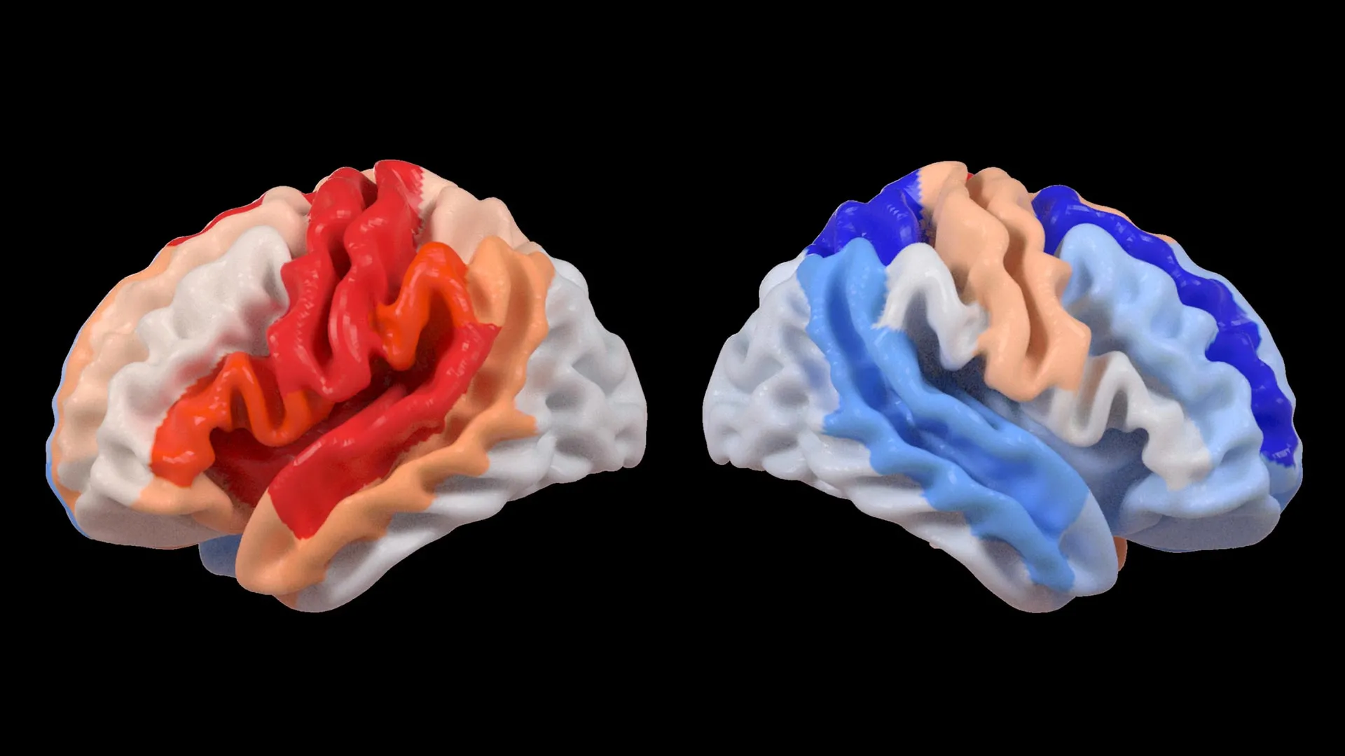 Acidente Vascular Cerebral Induz uma Transformação Oculta no Cérebro que Simula Revitalização